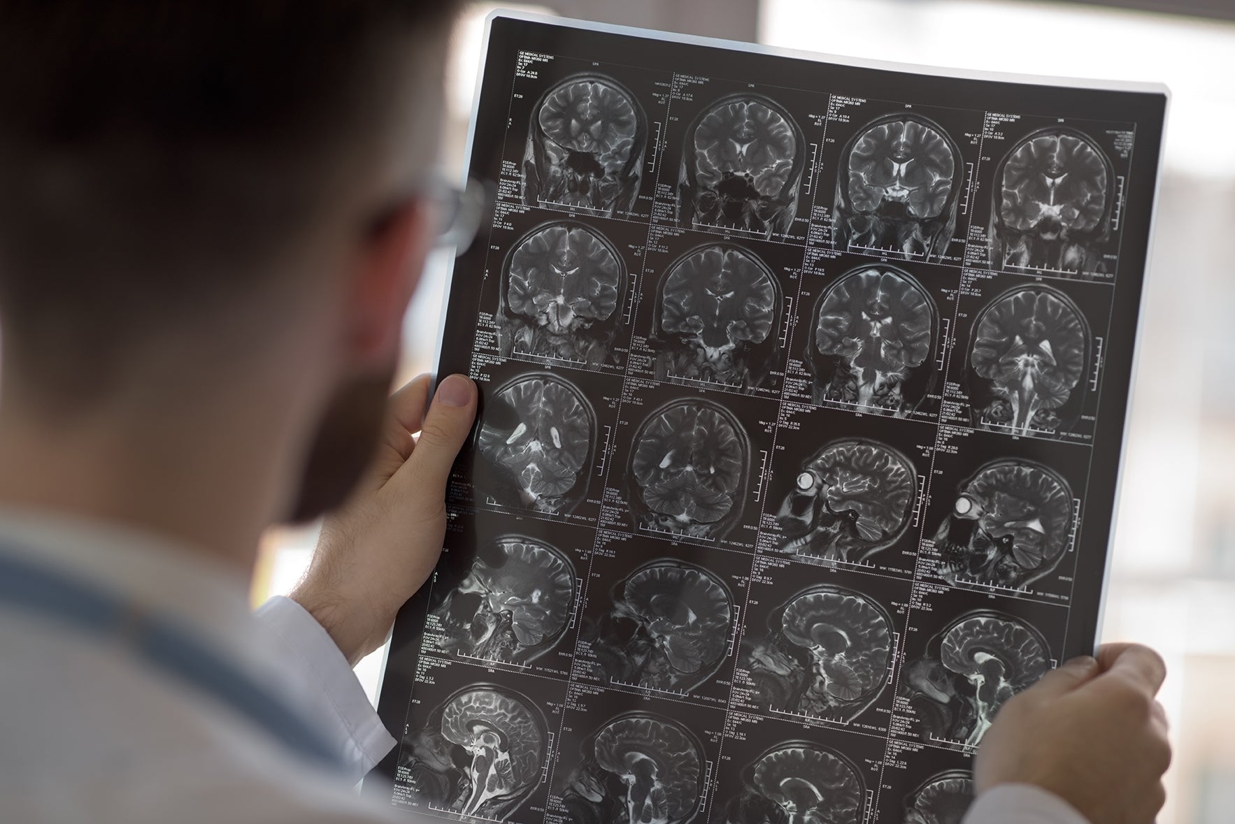 Stroke and Hyperbarics