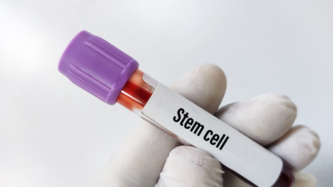 Planning Stem Cell Therapy? What to Know About Combining It With HBOT
