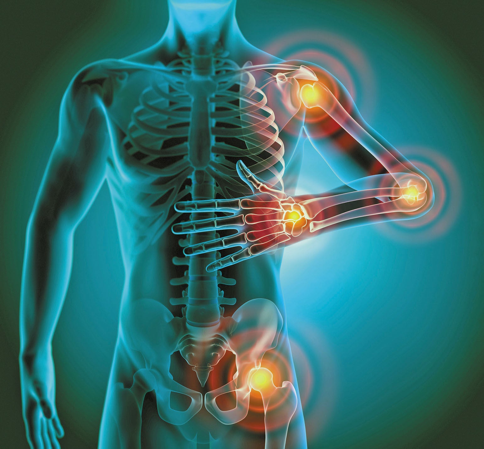 Hyperbaric Oxygen Therapy and Inflammatory Markers